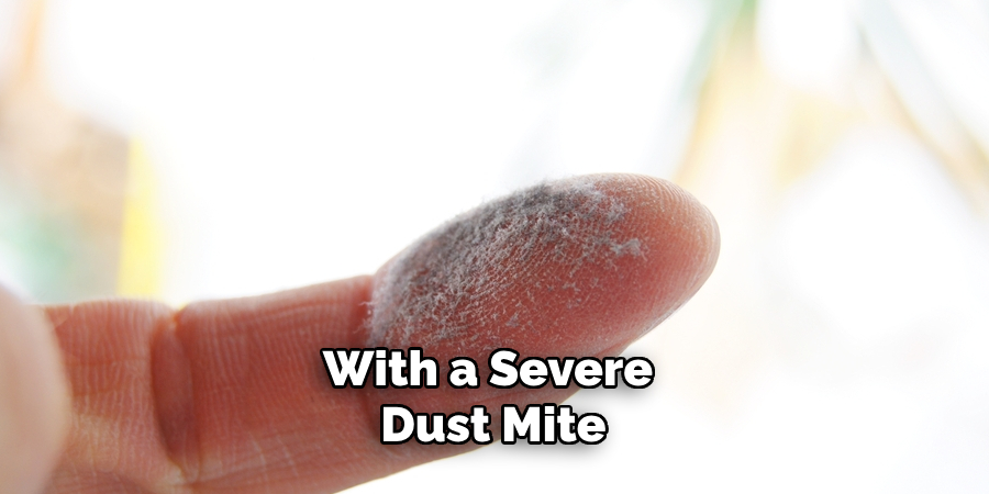 With a Severe Dust Mite